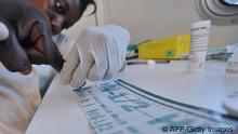 AIDS-Test in Westafrika (Foto: SIA KAMBOU/AFP/Getty Images) 